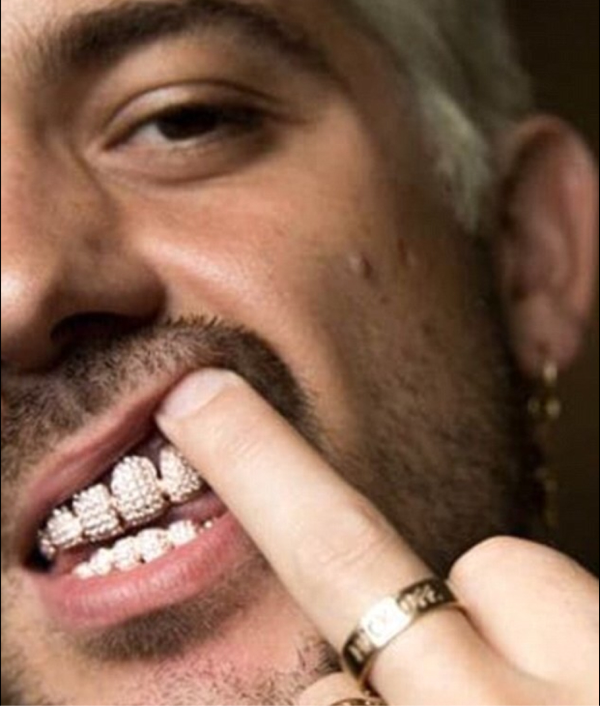 Rapper Ini Habiskan Rp445 Juta untuk Pasang 500 Berlian di Gigi