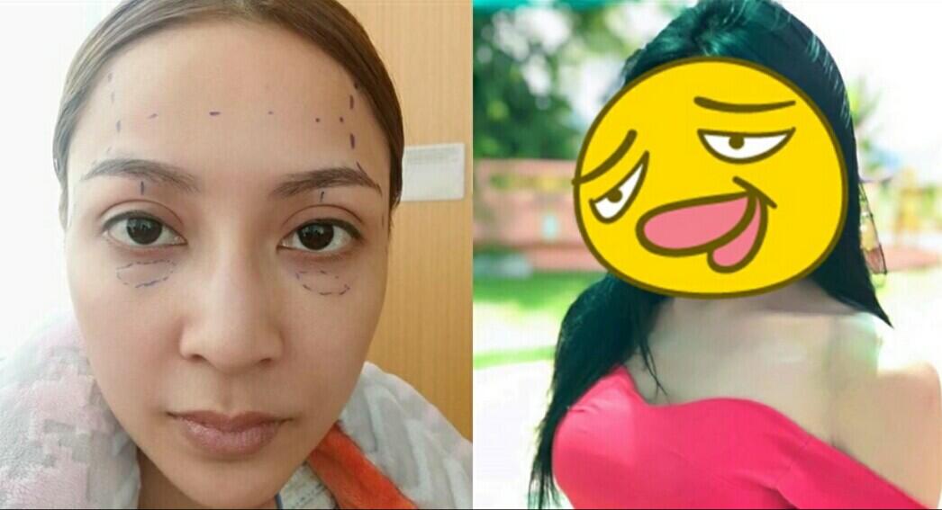 Operasi plastik pada wajah dengan hasil yang.....