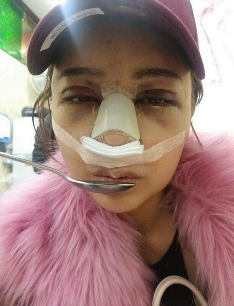 Operasi plastik pada wajah dengan hasil yang.....