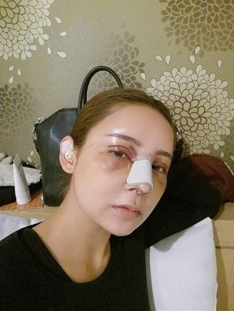 Operasi plastik pada wajah dengan hasil yang.....