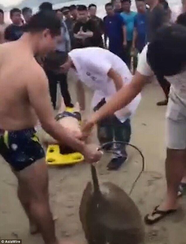 Malang nian Pria China ini, lagi santai di pantai, anunya di tusuk ikan pari