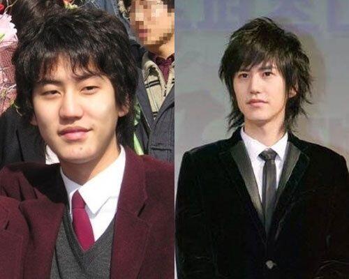 Sudah Menawan, 10 Artis Korea Ini Mengakui Operasi Plastik