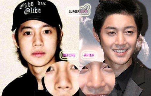 Sudah Menawan, 10 Artis Korea Ini Mengakui Operasi Plastik