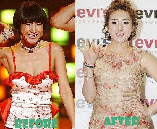 Sudah Menawan, 10 Artis Korea Ini Mengakui Operasi Plastik