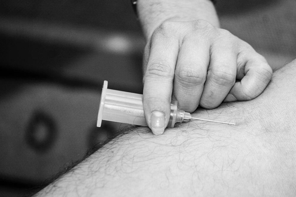 7 Hal Penting Tentang Rubella, Wabah Campak yang Kini Bangkit Kembali
