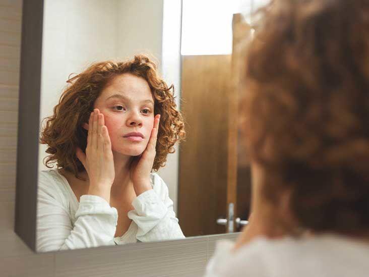 Girls, Masih Malu Diskusi Soal Rambut di Puting? Awas Indikasi Serius!