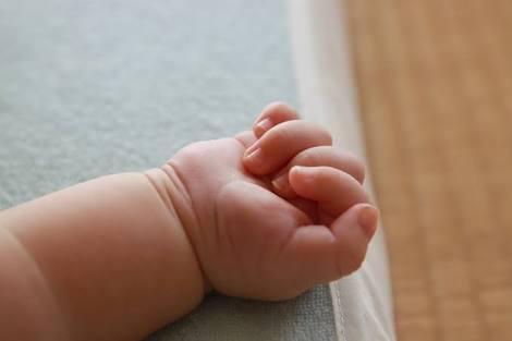 Bayi Bermata Satu Lahir di Sumatera Utara