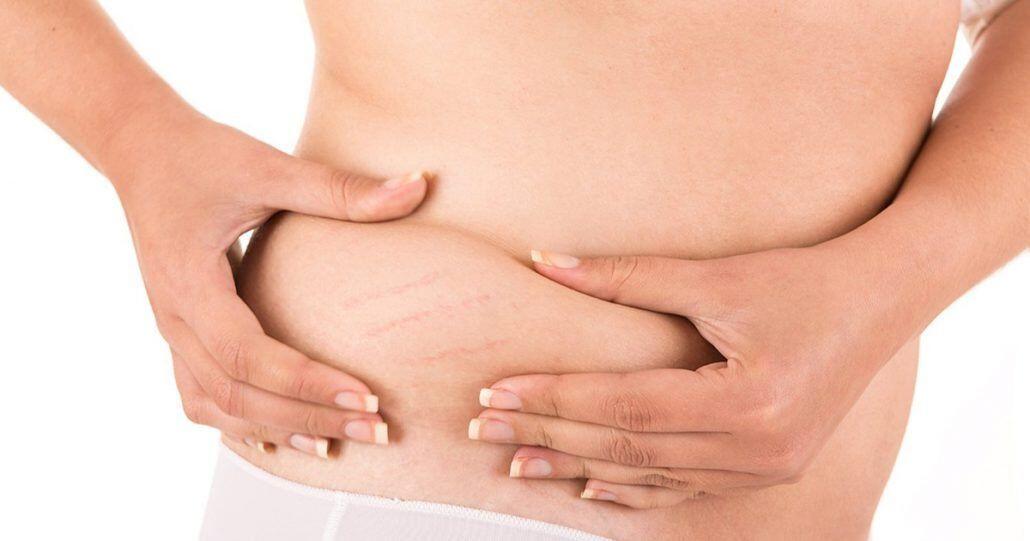 8 Perawatan Kecantikan dengan Kapsul Vitamin E, Bisa dari Rumah!
