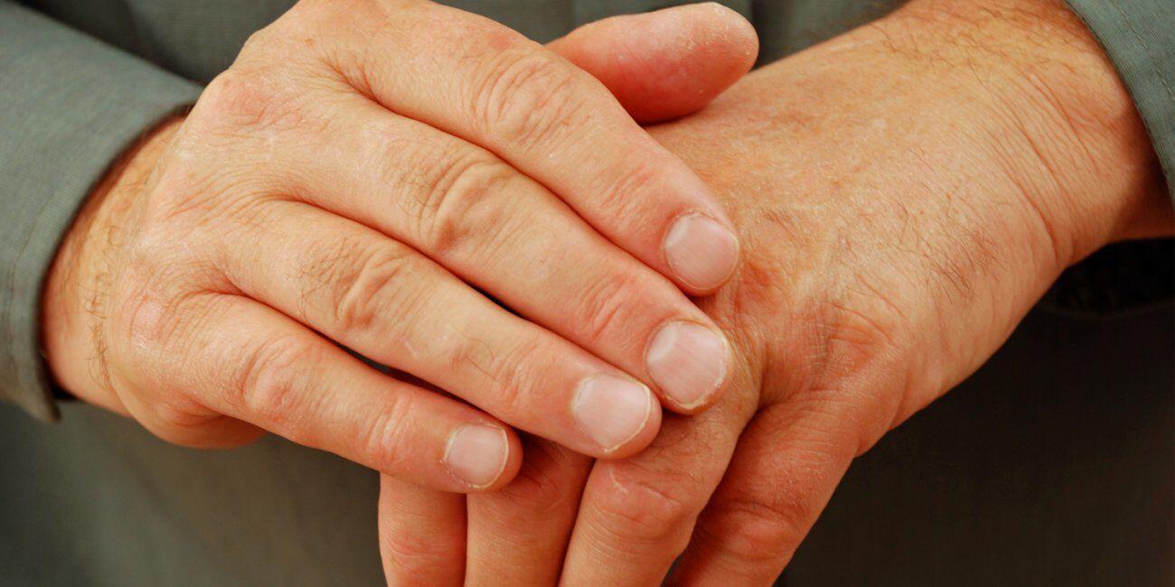 Sering Gunakan Hand Sanitizer Bisa Menyebabkan 5 Masalah Kulit Ini
