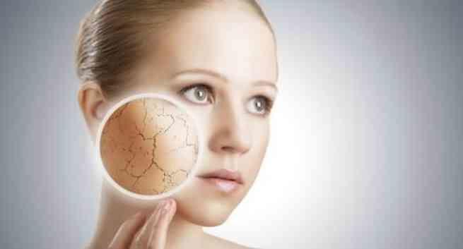Kenali Witch Hazel, Tanaman "Ajaib" yang Punya 7 Manfaat Hebat ini!
