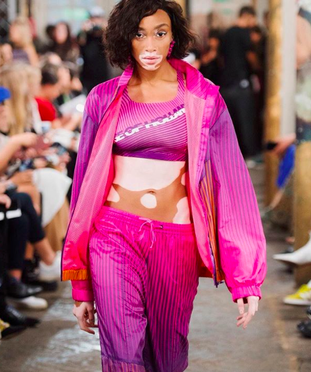 Model Berkulit Belang Nangis karena Didapuk Jadi Victoria&rsquo;s Secret Angel