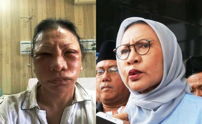 Ratna Sarumpaet Babak Belur Dianiaya Sejumlah Orang
