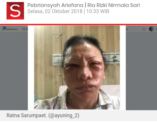 Cek ke 31 RS dan polsek, polisi belum temukan jejak penganiayaan Ratna Sarumpaet