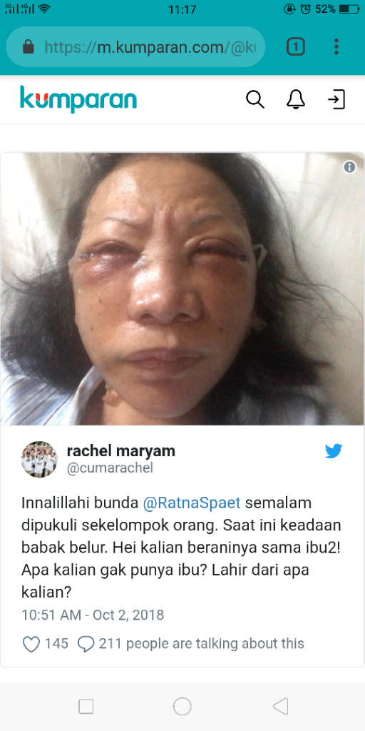 Ratna Sarumpaet Diduga Dianiaya hingga Babak Belur di Bandung