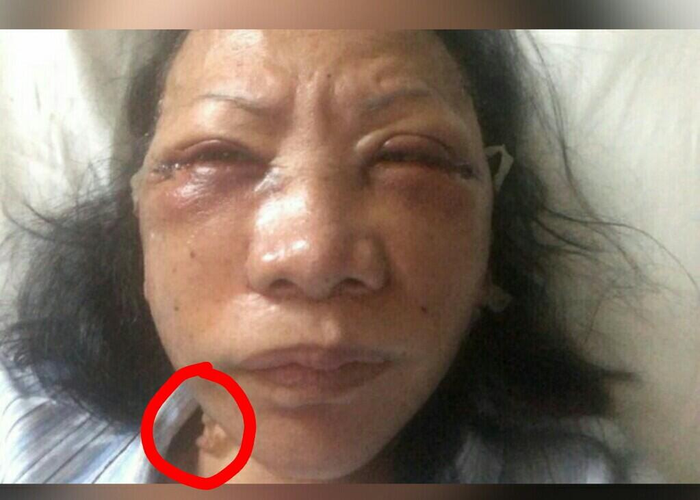 POLDA JABAR BELUM TERIMA LAPORAN PENGANIAYAAN RATNA SARUMPAET