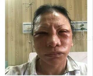 POLDA JABAR BELUM TERIMA LAPORAN PENGANIAYAAN RATNA SARUMPAET