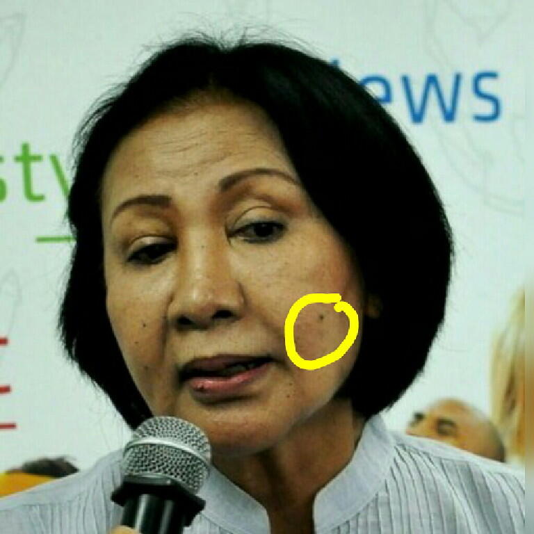 POLDA JABAR BELUM TERIMA LAPORAN PENGANIAYAAN RATNA SARUMPAET