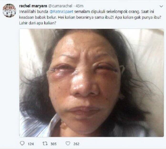Ratna Sarumpaet Dikeroyok Orang Tak Dikenal, Prabowo-Sandi Akan Jenguk