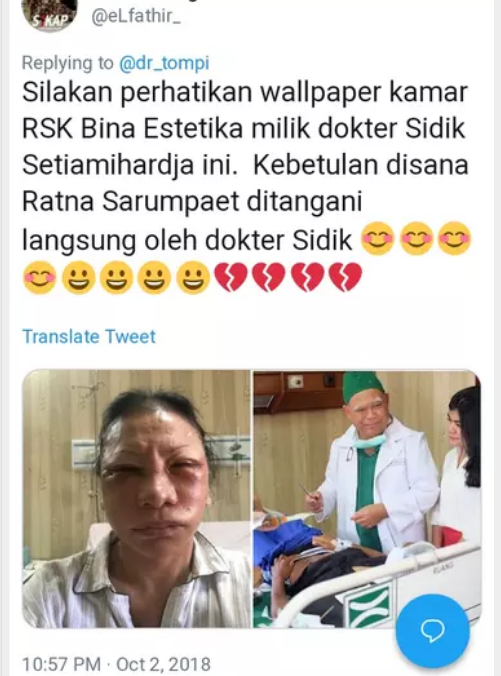 Tompi Yakin Ratna Sarumpaet Memar Cuma karena Operasi Plastik + BUKTI