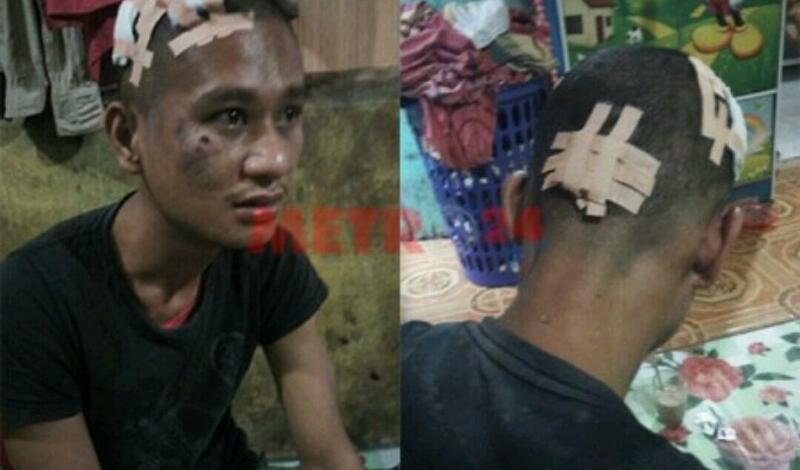 Fadli Bonyok Dikeroyok 12 Orang, Diikat Tiang Listrik & Ditelanjangi & Diseret Motor