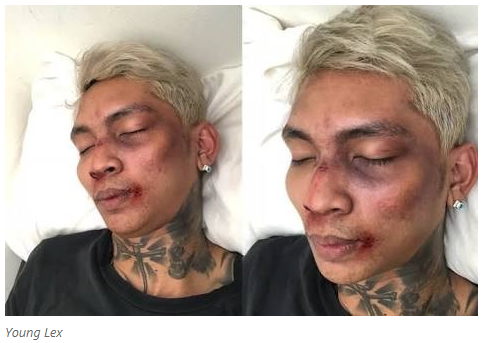 Benarkah Ratna Sarumpaet Dianiaya? Atau Tiru Sensasi Young Lex?
