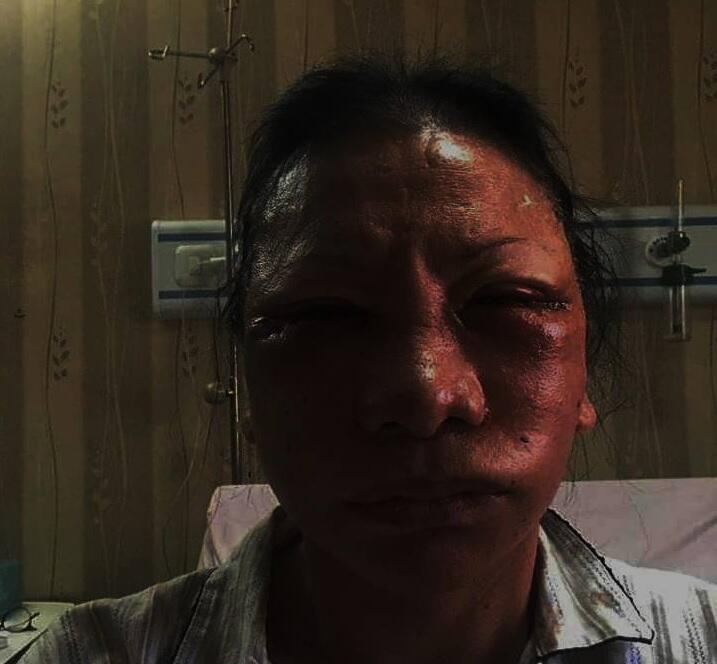 6 Meme Drama Oplas Ratna Sarumpaet, dari Jadi Valak sampai Dijejerin Lucinta Luna