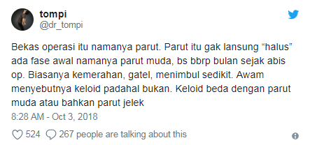 Serba-serbi prosedur operasi plastik