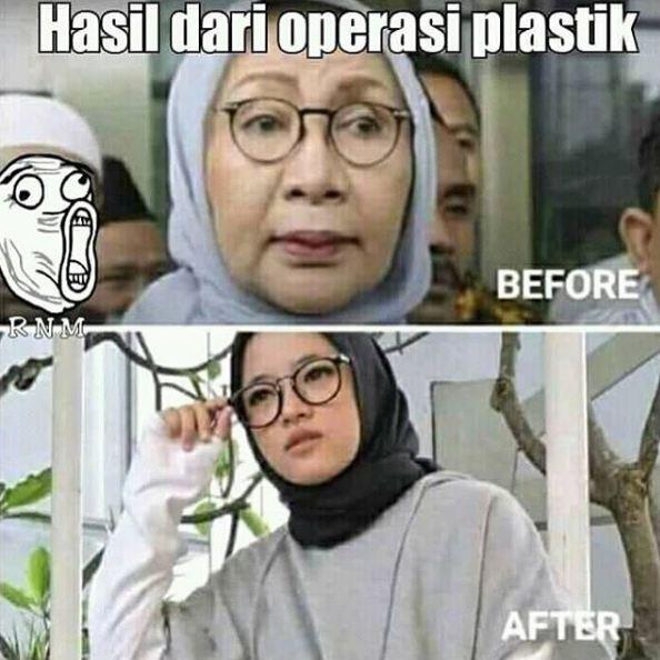 Serba-serbi prosedur operasi plastik