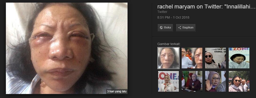 Polri Sebut Berita Bohong Ratna Tanggung Jawab Penyebar Di Media Sosial