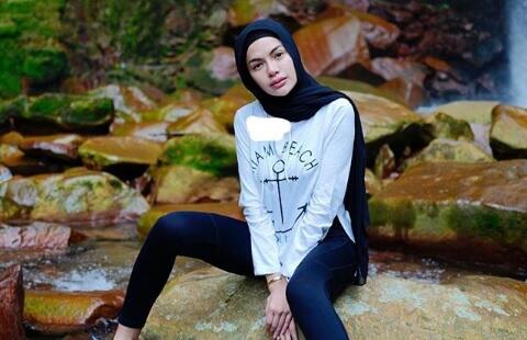 Nggak Bohong Kayak Ratna Sarumpaet! Artis-artis Ini Malah Ngaku Operasi Plastik