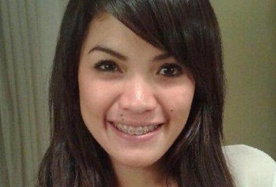 Nggak Bohong Kayak Ratna Sarumpaet! Artis-artis Ini Malah Ngaku Operasi Plastik