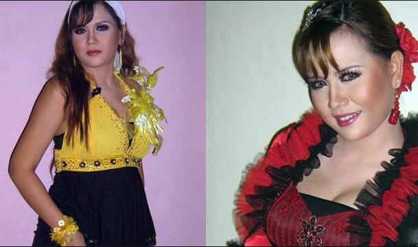 Nggak Bohong Kayak Ratna Sarumpaet! Artis-artis Ini Malah Ngaku Operasi Plastik