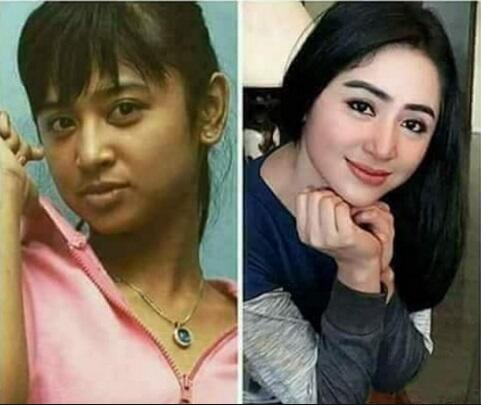 Nggak Bohong Kayak Ratna Sarumpaet! Artis-artis Ini Malah Ngaku Operasi Plastik