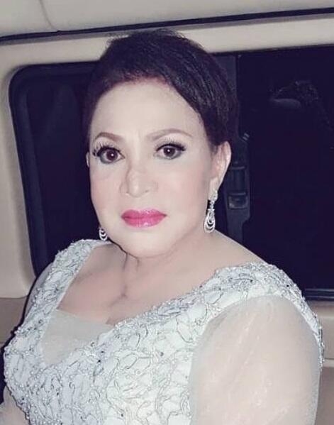 Nggak Bohong Kayak Ratna Sarumpaet! Artis-artis Ini Malah Ngaku Operasi Plastik