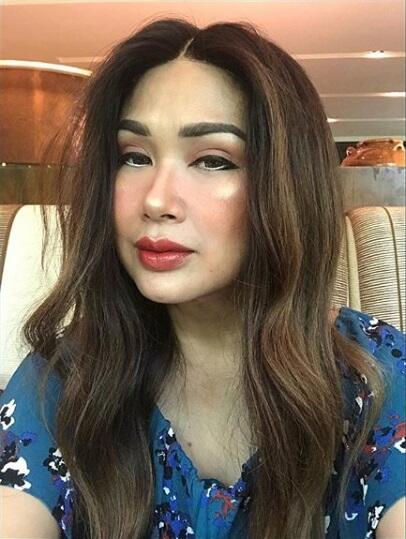 Nggak Bohong Kayak Ratna Sarumpaet! Artis-artis Ini Malah Ngaku Operasi Plastik