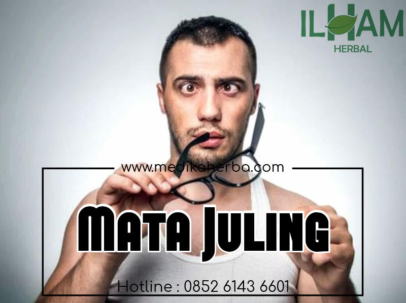 Ketahui! Penyakit Mata Juling Sejak Awal