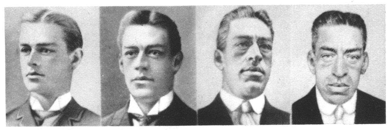 Adam Rainer: Satu-satunya yang Dijuluki Kerdil dan Raksasa Sekaligus