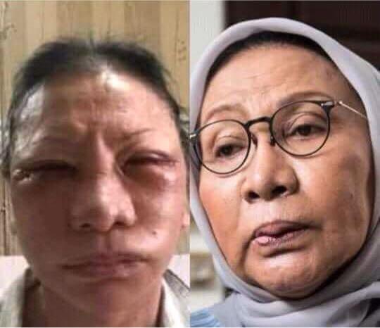 Ada Foto Ratna Sarumpaet di Laptop Amien Rais