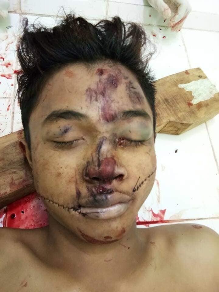 update pembunuhan kemaren