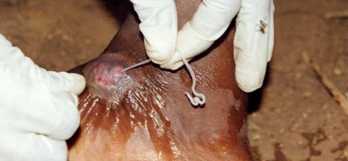 4 Hewan Kecil yang Bisa Memakan Agan Dari Dalam Tubuh