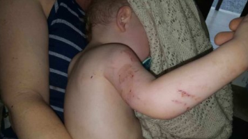 Balita Ini Selamat dari Lilitan Ular Piton Sepanjang 4 Meter