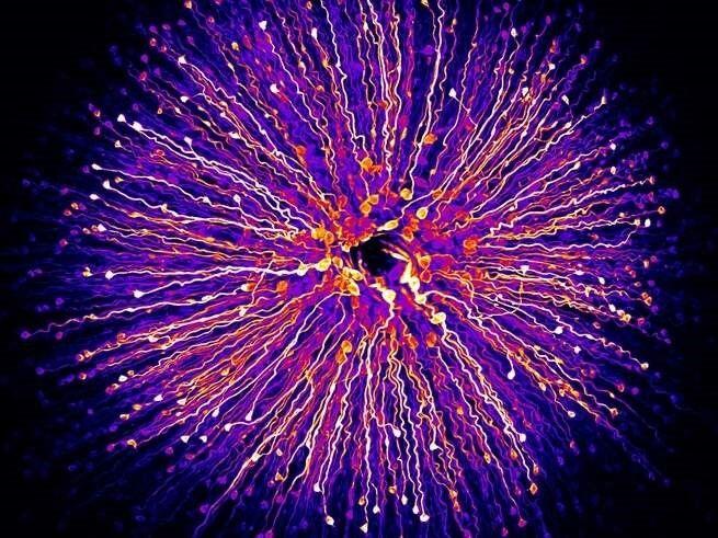 15 Foto Menakjubkan dari Pemenang Nikon’s Small World Photography 2018