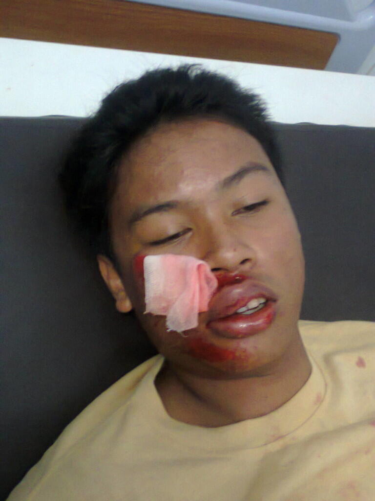 Motoran Sambil Melamun, Pria Ini Nyium Aspal