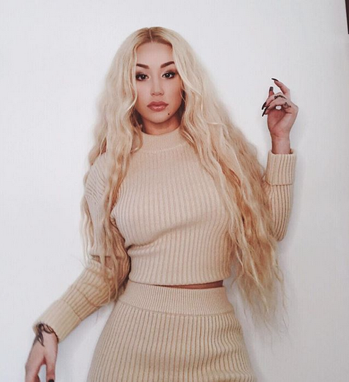 Iggy Azalea Dikabarkan Oplas hingga Rp 150 Juta, Seperti Apa?