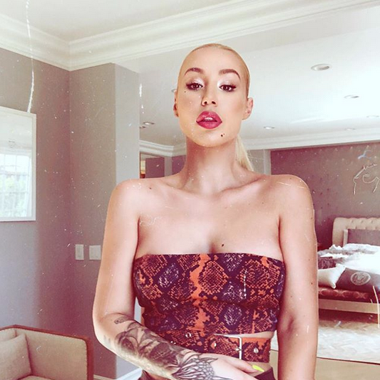 Iggy Azalea Dikabarkan Oplas hingga Rp 150 Juta, Seperti Apa?