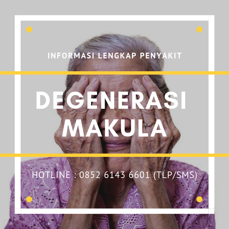 Awas! Degenerasi Makula Bisa Merenggut Penglihatan