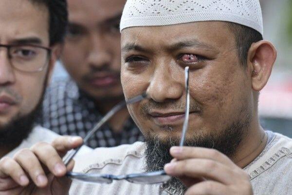 Novel Baswedan: Penyerangan Terhadap Saya Sengaja Tidak Diungkap