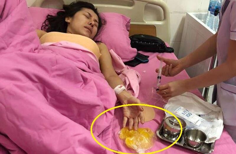 Implan Payudara Penyanyi Ini Meledak di Pesawat....ngerih kali bah fotonya !