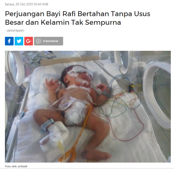 Masih Ingat Kisah Rafi, Anak yang Terlahir Tanpa Lubang Anus dan Usus Besar Ini Gan? 