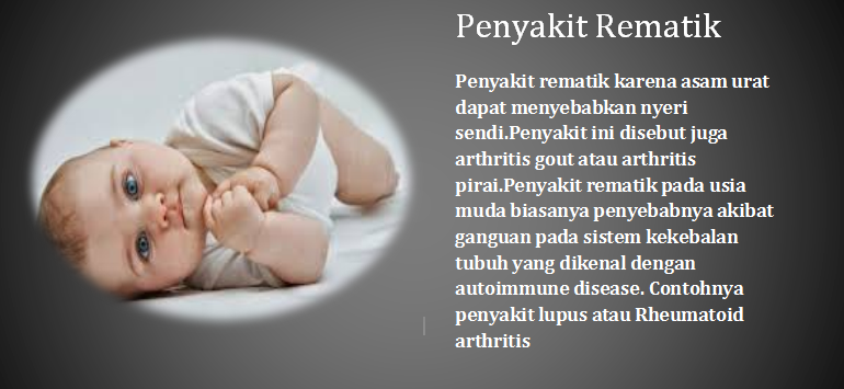 Benarkah penyakit Rematik bisa menyerang bayi yang baru lahir ?